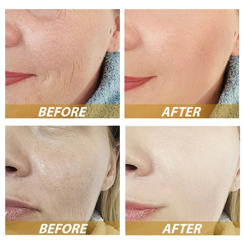 Wrinkle Removal Retinol Serum  Facial Serum Rejuvenation Lift Firming Anti-aging Whitening Invisible Pores Beauty Skin Care