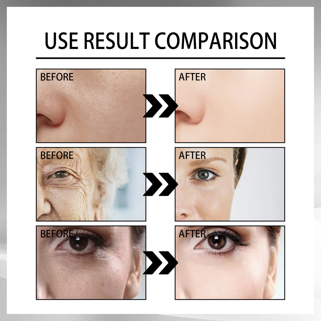 Skin Anti-Aging Cream